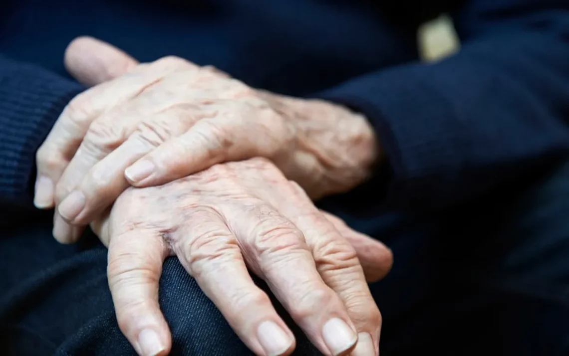 Demência ligada a Parkinson;